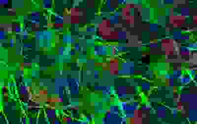 跟踪细丝