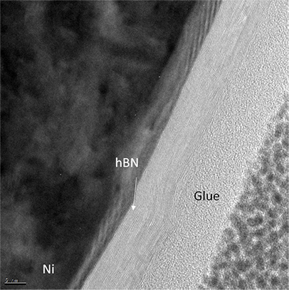 心血管疾病的增长hBN