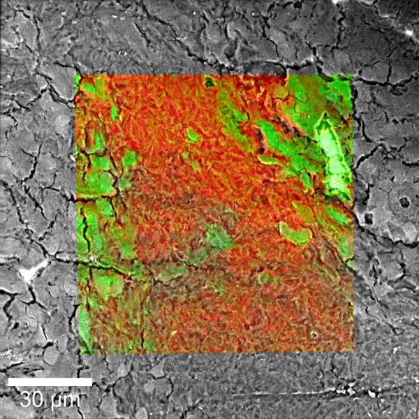 脑组织的上升显微镜（拉曼 -  SEM）图像。